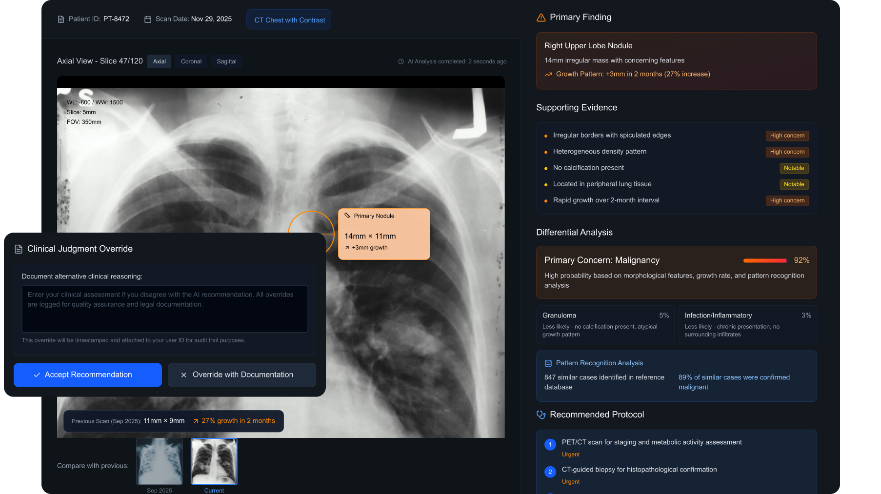 Annotated radiology interface showing marked areas and clinical reasoning panel